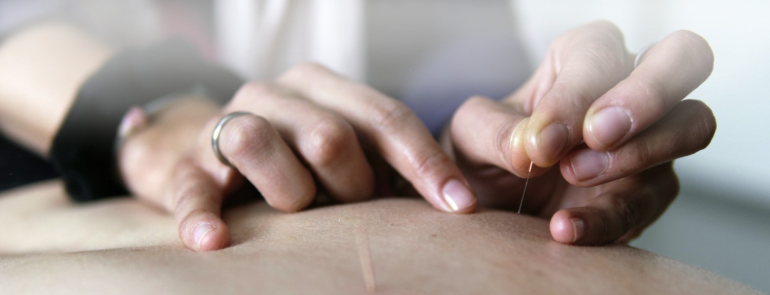 Akupunktur_header_white