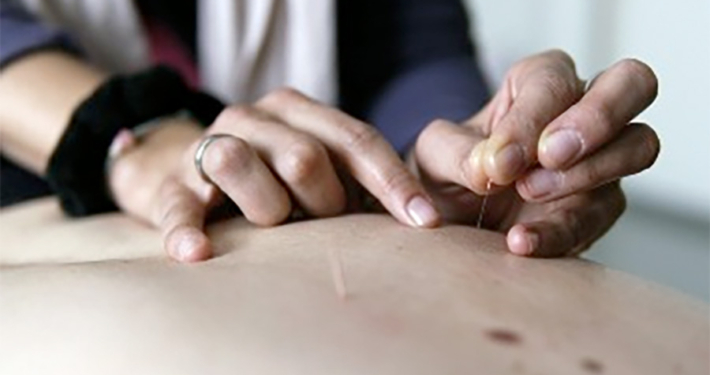 akupunktur-uebersicht-900